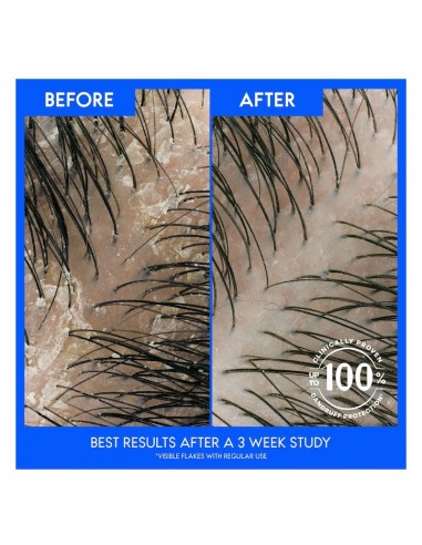 Shampoo Anticaspa Head & Shoulders Deep Scalp...